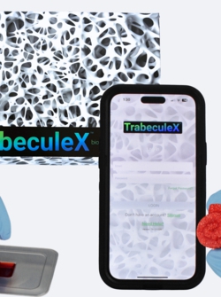 Xenco Medical חושפת את TrabeculeX Continuum